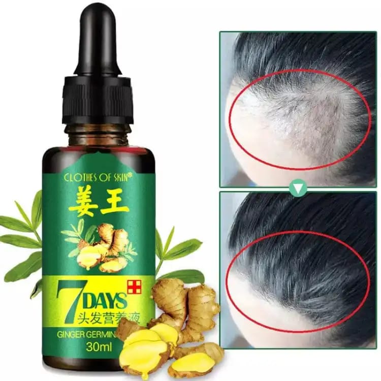 7 Days Hair Growth Germinal Serum Oil strengthen hair roots and improve the overall appearance of dry (30ML)