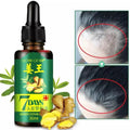 7 Days Hair Growth Germinal Serum Oil strengthen hair roots and improve the overall appearance of dry (30ML)